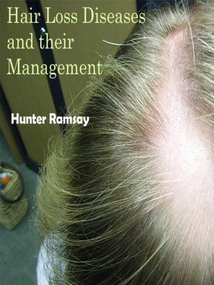 cover image of Hair Loss Diseases and their Management
